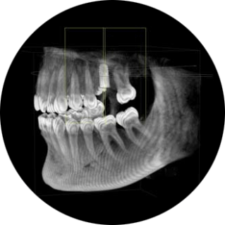 3D-Röntgenbild - zahnarztzentrum.ch
